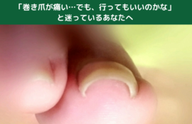 「巻き爪が痛い…でも、行ってもいいのかな」と迷っているあなたへ