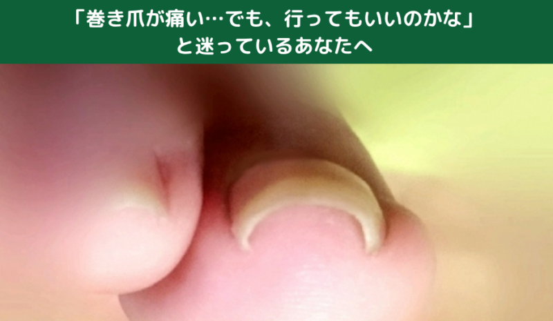 「巻き爪が痛い…でも、行ってもいいのかな」と迷っているあなたへ